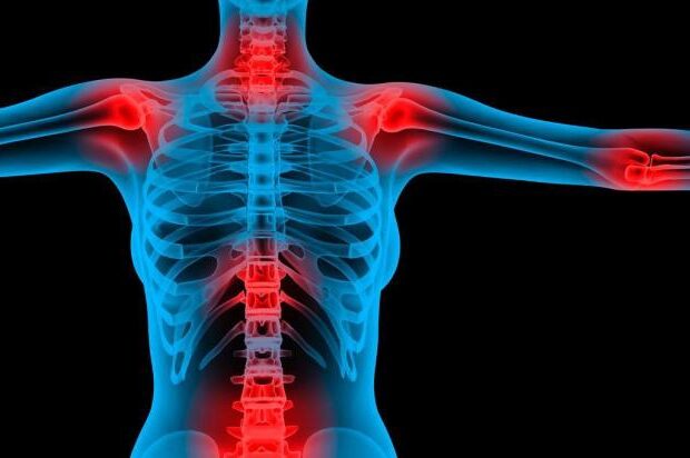 Fibromialgia, il progetto di legge arriva in Consiglio