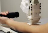 Negli Usa arriva il robot che fa i prelievi: trova la vena e inserisce l’ago da solo