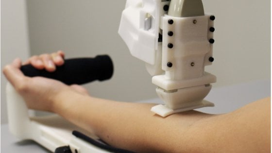Negli Usa arriva il robot che fa i prelievi: trova la vena e inserisce l’ago da solo