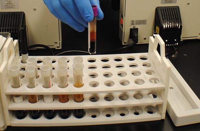 Fee-based lab tests: parliamentary committee opens the door