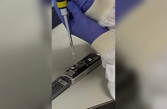 Tumori al cervello, la diagnosi da otto settimane a due ore